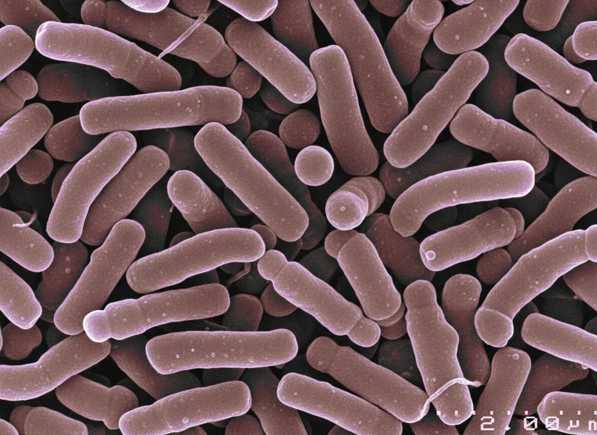 Bifidobacterium longum